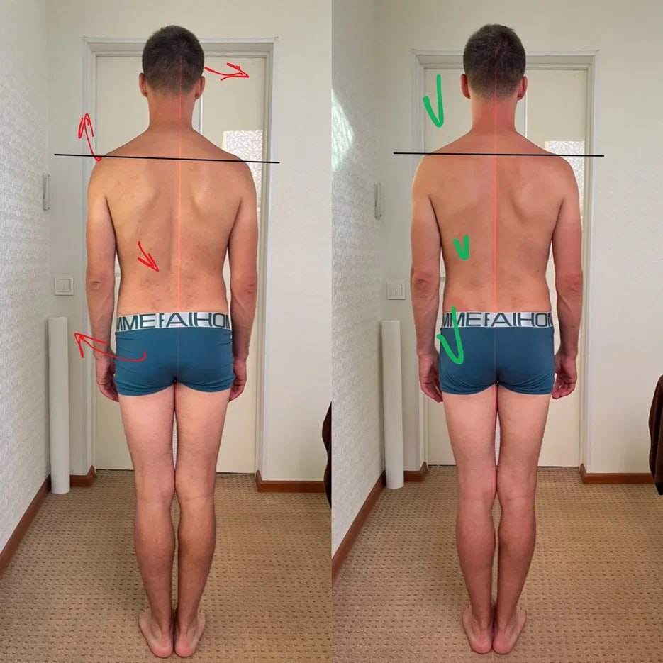 Постепенное восстановление симметрии и свободы движения⬅️