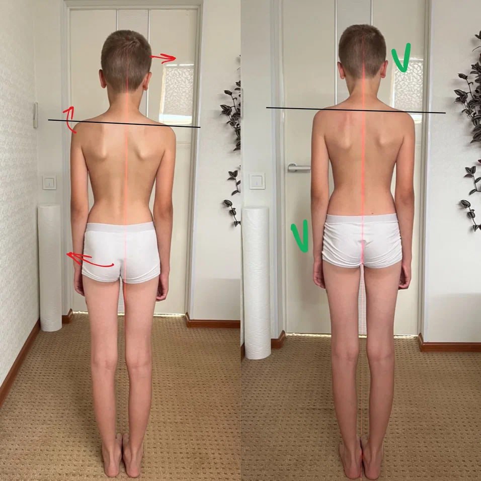 Видимые изменения после коррекции⬅️