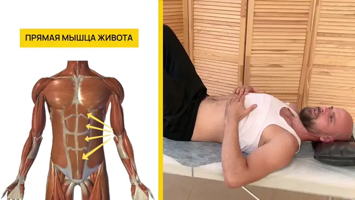 Прямая мышца живота — основа стабильности корпуса👁️